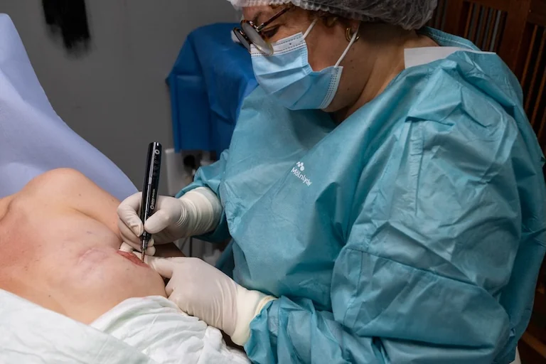 À Lille, le tatouage qui répare après un cancer du sein